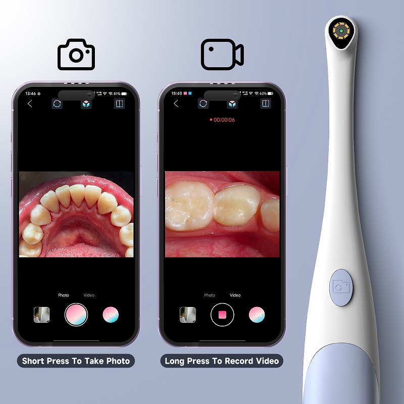 口腔内視鏡カメラ 1440P 写真&ビデオハンドヘルドビジュ - Photography Lighting Professional のレビューと価格